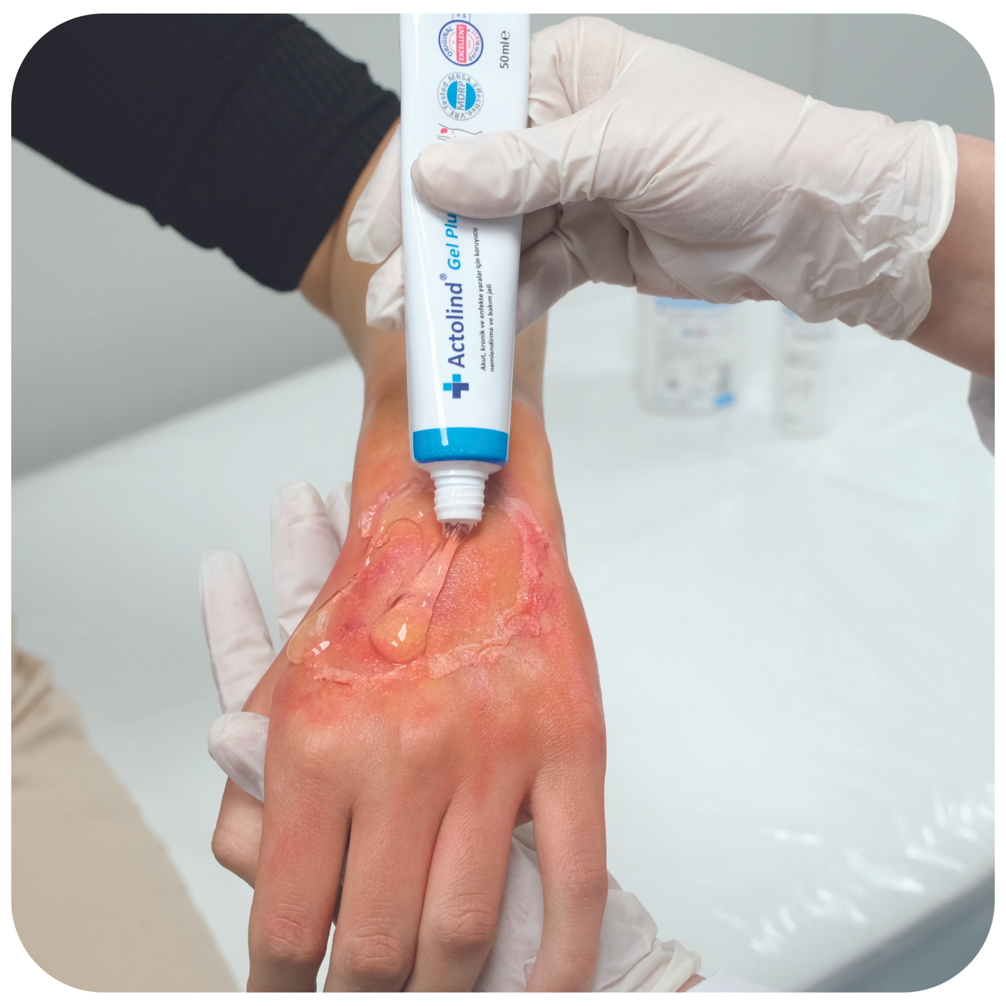 Actolind | Wound Dressing and Care Products